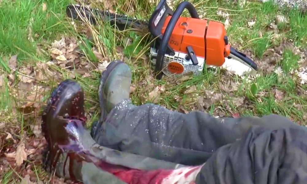 Belecsúszott a láncfűrész a lábába, majdnem elvérzett a férfi