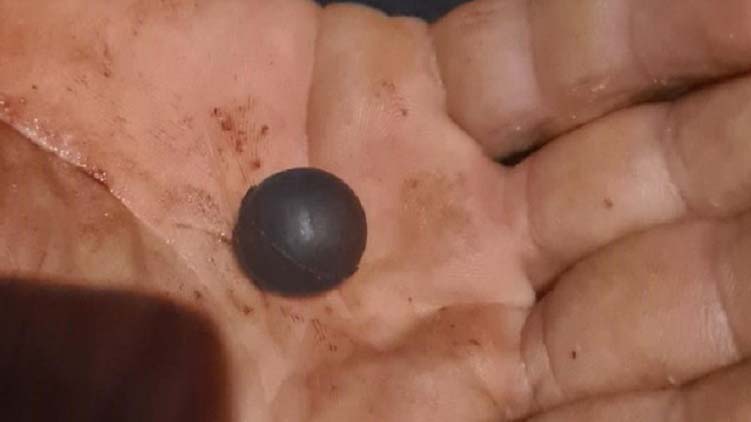 „Megdöglesz, meghal az egész családod!” – kézen lőtte vejét egy 58 éves férfi Kiskunlacházán, mert lánya érdekeit védte